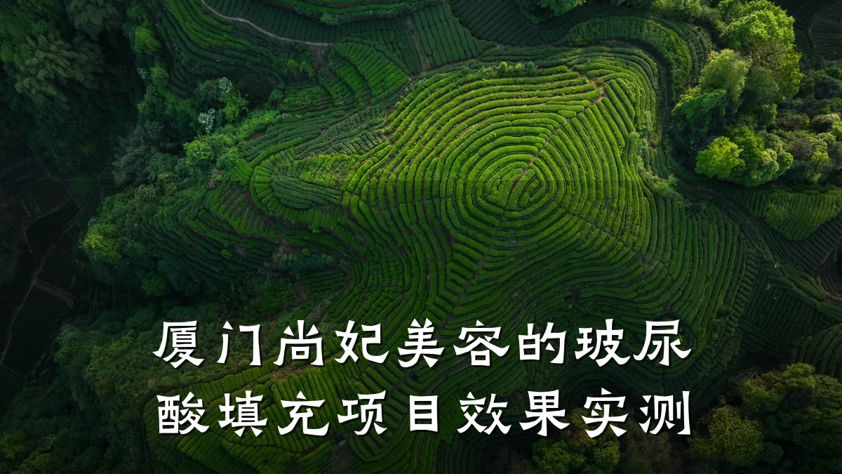 厦门尚妃美容的玻尿酸填充项目效果实测